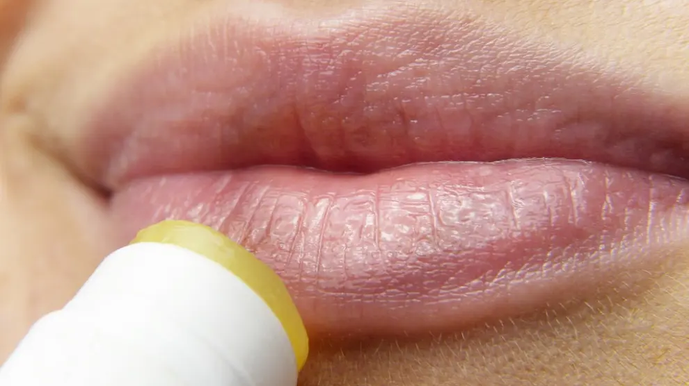 Unos de los más habituales suelen ser los herpes labiales