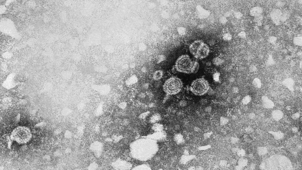 El virus de la hepatitis B, visto al microscopio electrónico.