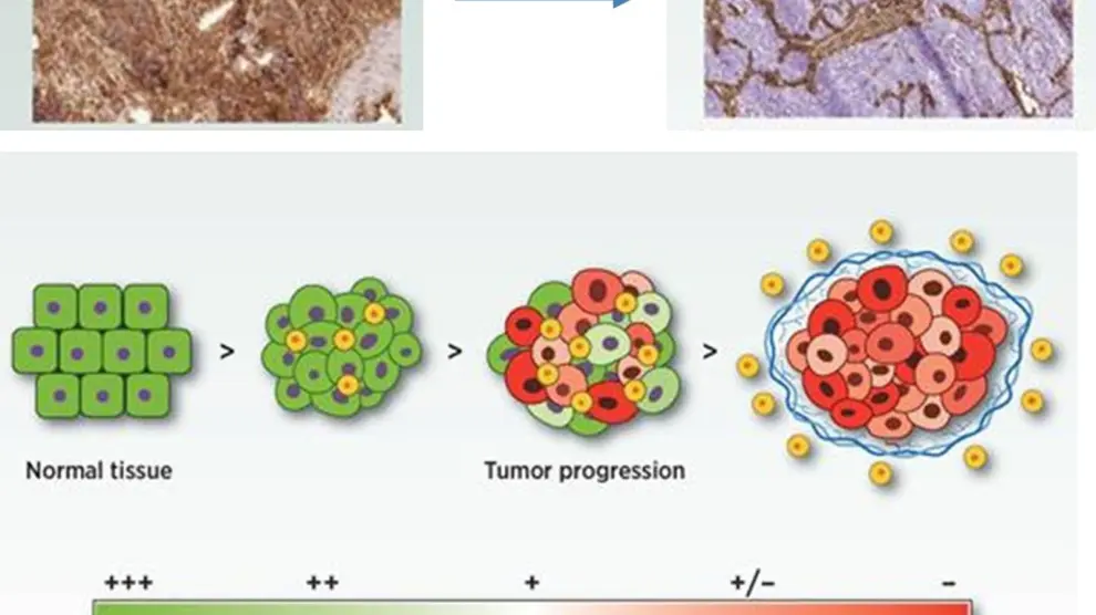 Demuestran el papel de unas proteínas para ayudar al sistema inmune a detectar el cáncer