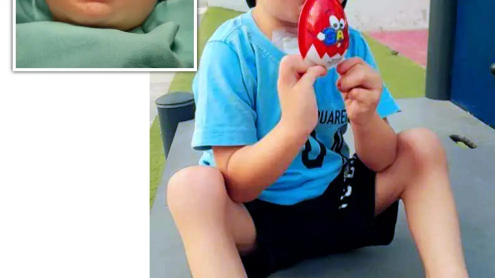 Niño intervenido en el Hospital Vithas Valencia 9 de Octubre