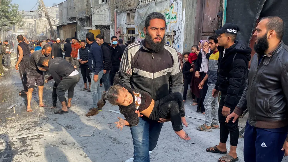 Una niña herida en uno de los ataques israelíes en Gaza