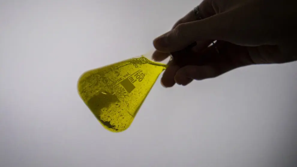 El descubrimiento de una enzima desvela el misterio del color amarillo de la orina