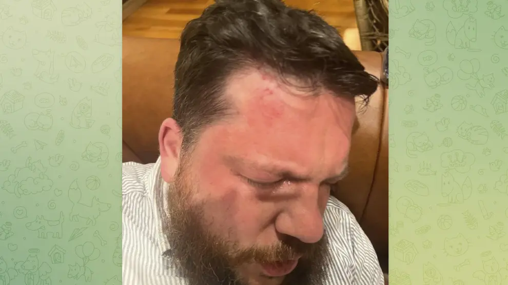 Imagen capturada de Telegram que muestra las heridas sufridas por Leonid Volkov