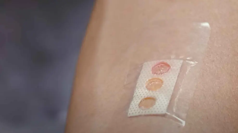 Tirita con tecnología láser para monitorizar la glucosa en sangre