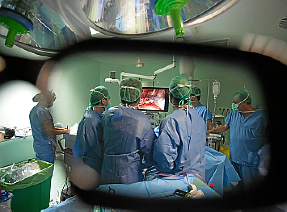 Un vistazo con gafas 3D permite observar con detalle la acción del corte y cosido del estómago con su nuevo tamaño