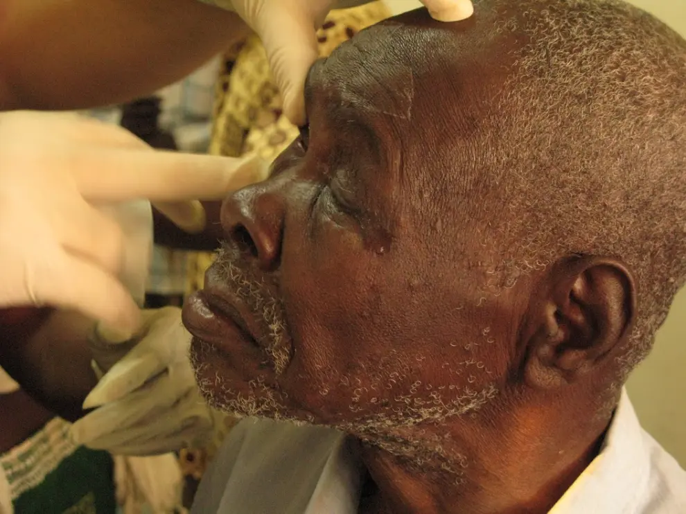 El enfermero zaragozano y cooperante de Ilumináfrica, David Morer, atendiendo a un paciente en el Chad.