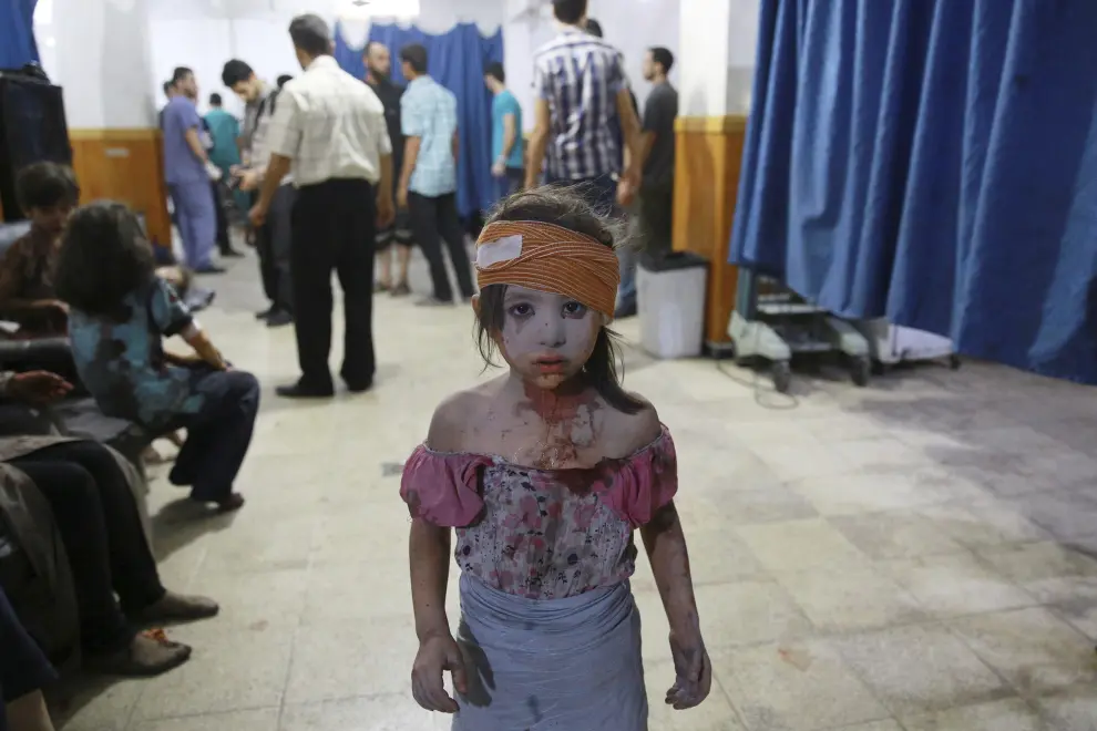 Fotografía de la serie ganadora del segundo premio de la categoría de temas de actualidad de la 59 edición del World Press Photo, tomada por el fotógrafo Abd Doumany. La fotografía muestra a un niña siria que ha sido atendida en un hospital en la ciudad de Douma