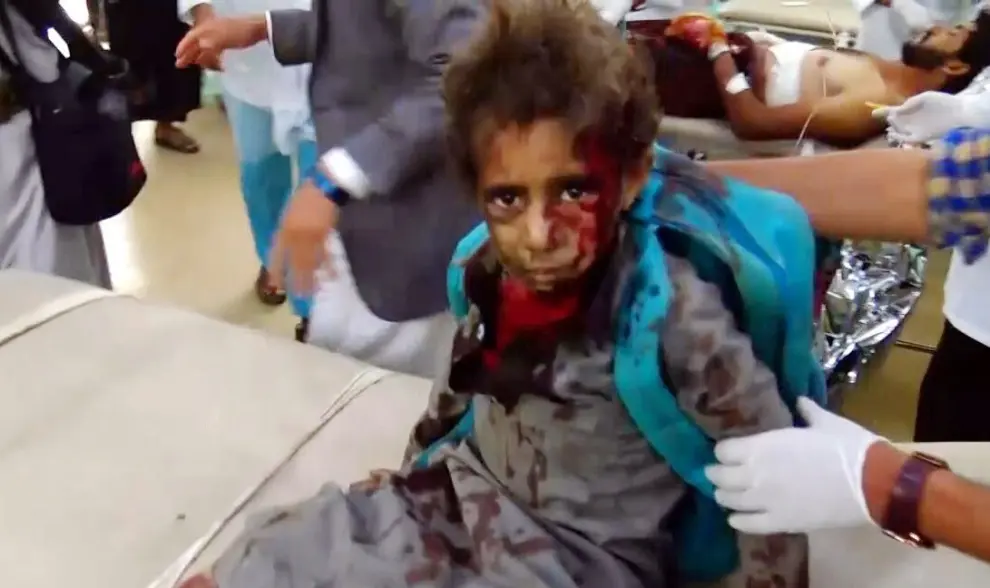 Bombardeo en Yemen