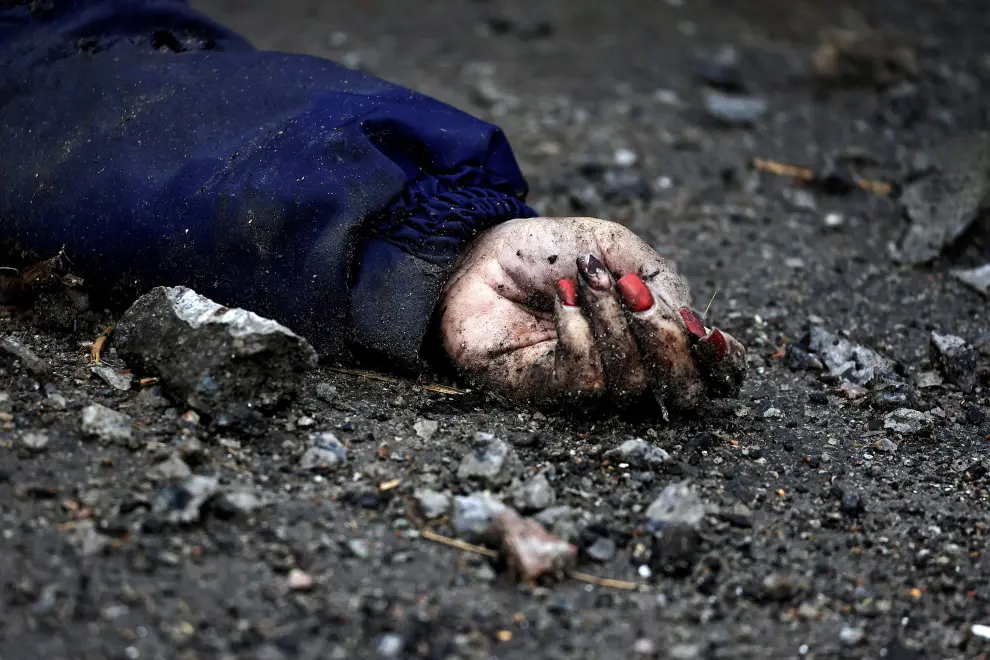 La mano de Iryna Filkina, una mujer que murió tras el ataque ruso en Bucha.
