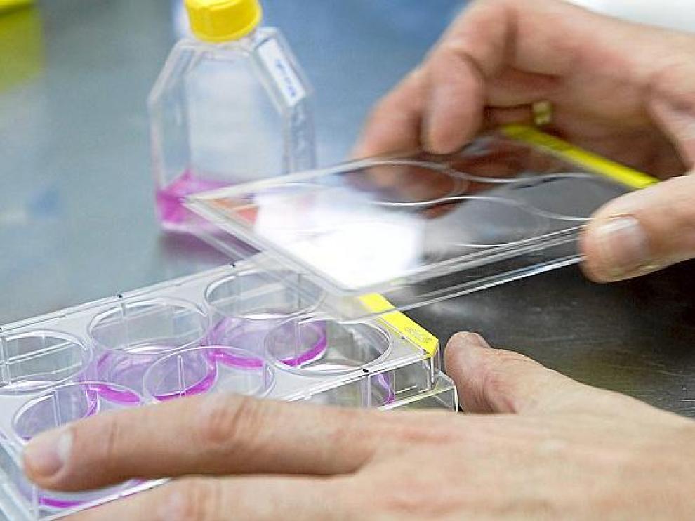 Pruebas de diagnóstico de cáncer, en el laboratorio