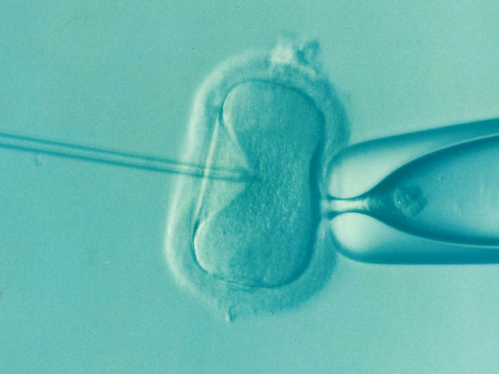 Fertilización in vitro