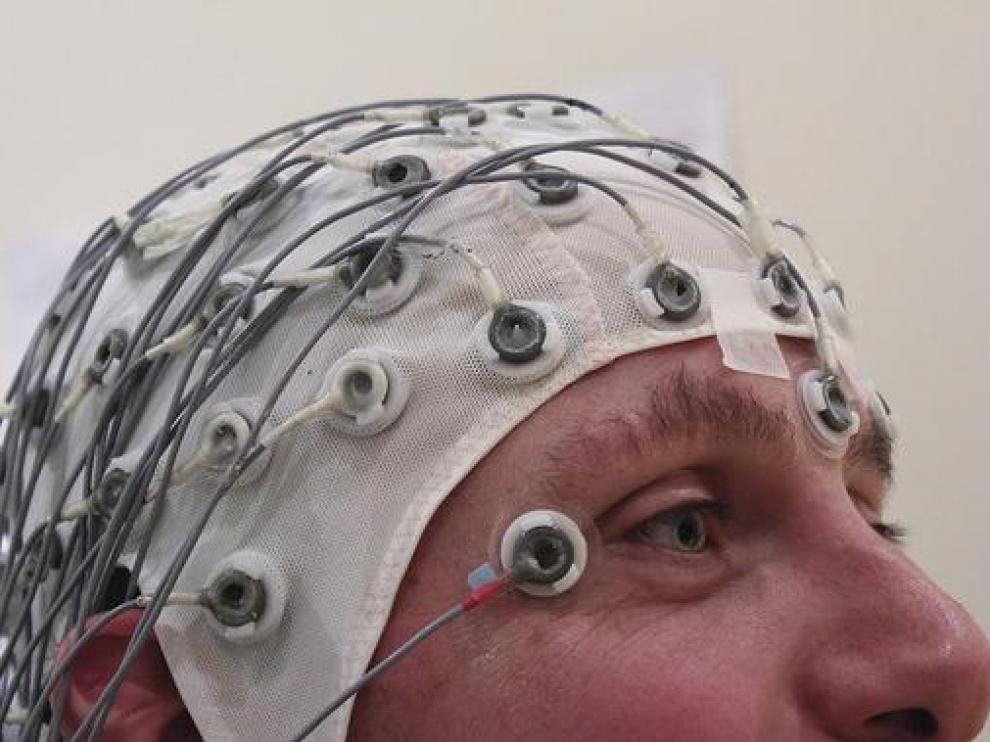 Electroencefalografía.