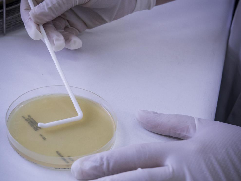 Así se trabaja en Aragón contra la listeriosis