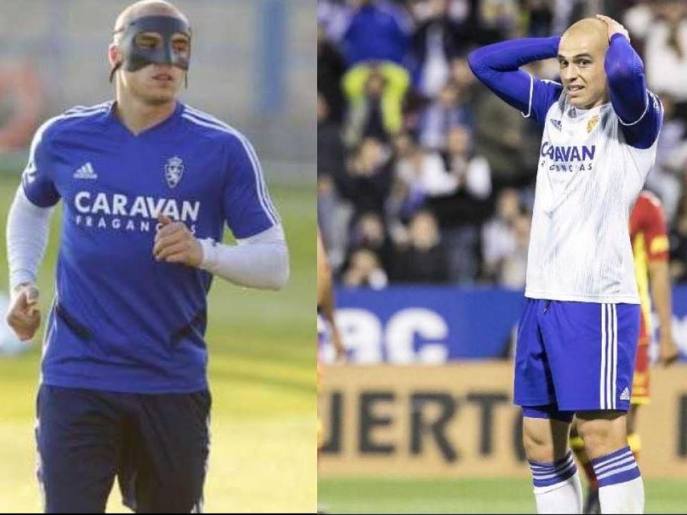 Pombo, la semana pasada, primero con la máscara protectora de su ojo derecho operado y, después, sin ella durante el partido ante Las Palmas.