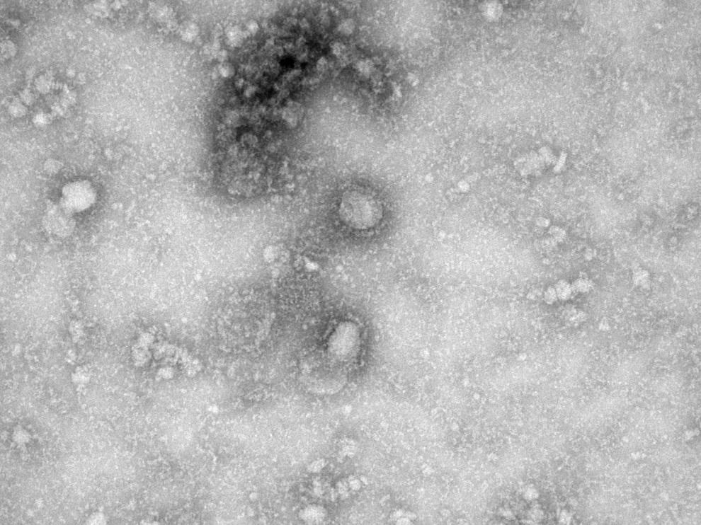 El coronavirus a vista de microscopio