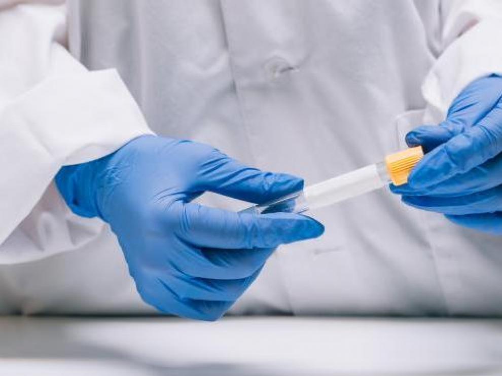 Estos son los casos confirmados de muertos y contagiados de coronavirus en Aragón