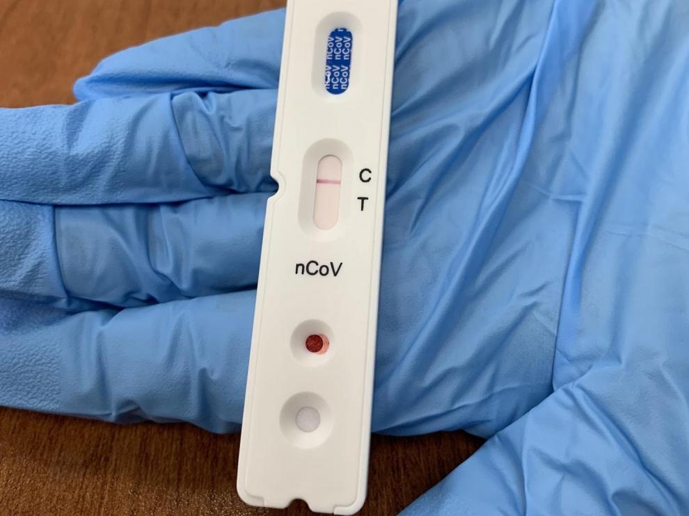 Camp Mabry (United States), 08/04/2020.- A handout photo made available by the Texas Military Department shows a example of a negative rapid test for the SARS-CoV-2 virus, which causes the COVID-19, in Camp Mabry, Austin, Texa, USA, 08 April 2020 (issued 15 April 2020). The Texas Military Department has begun distributing rapid COVID-19 tests to its service members across the state as a force health protection measure. This will ensure that the Soldiers and Airmen serving their communities during the COVID-19 pandemic remain healthy and safe. (Estados Unidos) EFE/EPA/CHARLES E. SPIRTOS/TEXAS MILITARY DEPARTMENT HANDOUT HANDOUT EDITORIAL USE ONLY/NO SALES COVID-19 screening test for military service members in Texas