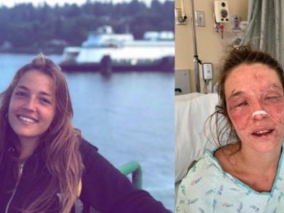 Marta Bustos antes y después del accidente