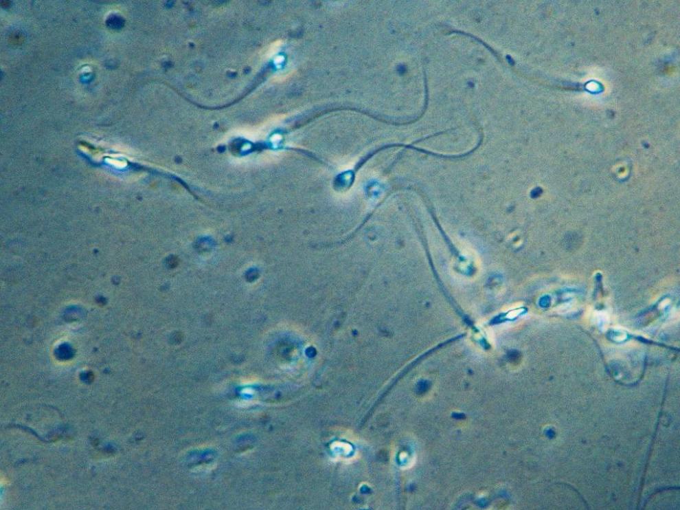 Espermatozoides.