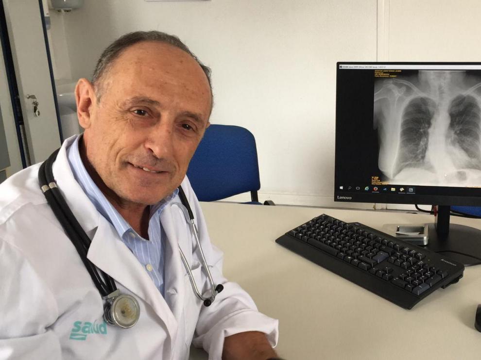 El neumólogo aragonés José María Marín, en el Hospital Miguel Servet de Zaragoza.