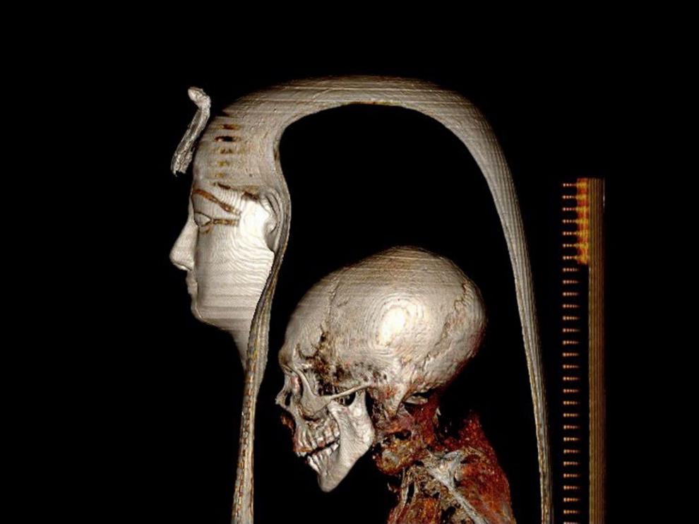 Los investigadores de la Universidad de El Cairo publica en 'Frontiers in Medicine' el resultado de su investigación sobre la momia de Amenhotep EGYPT MONUMENTS RESEARCH