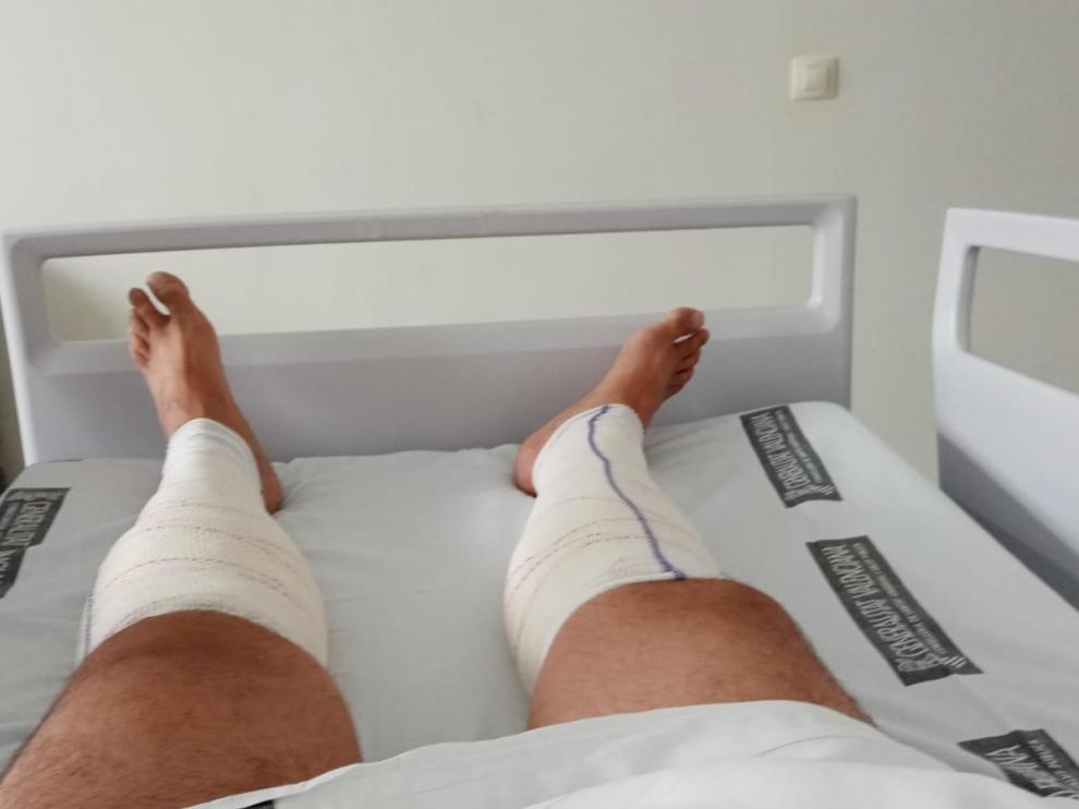 Herido zaragozano en el tren alcanzado por el incendio de Bejís (Castellón).