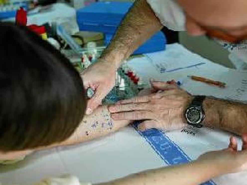 Las pruebas cutáneas son decisivas en el diagnóstico.