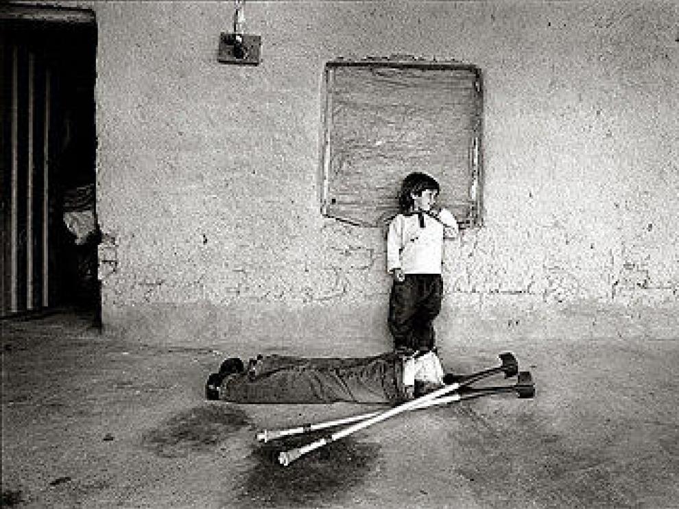 Imagen de Gervasio Sánchez, 'Vidas minadas'.