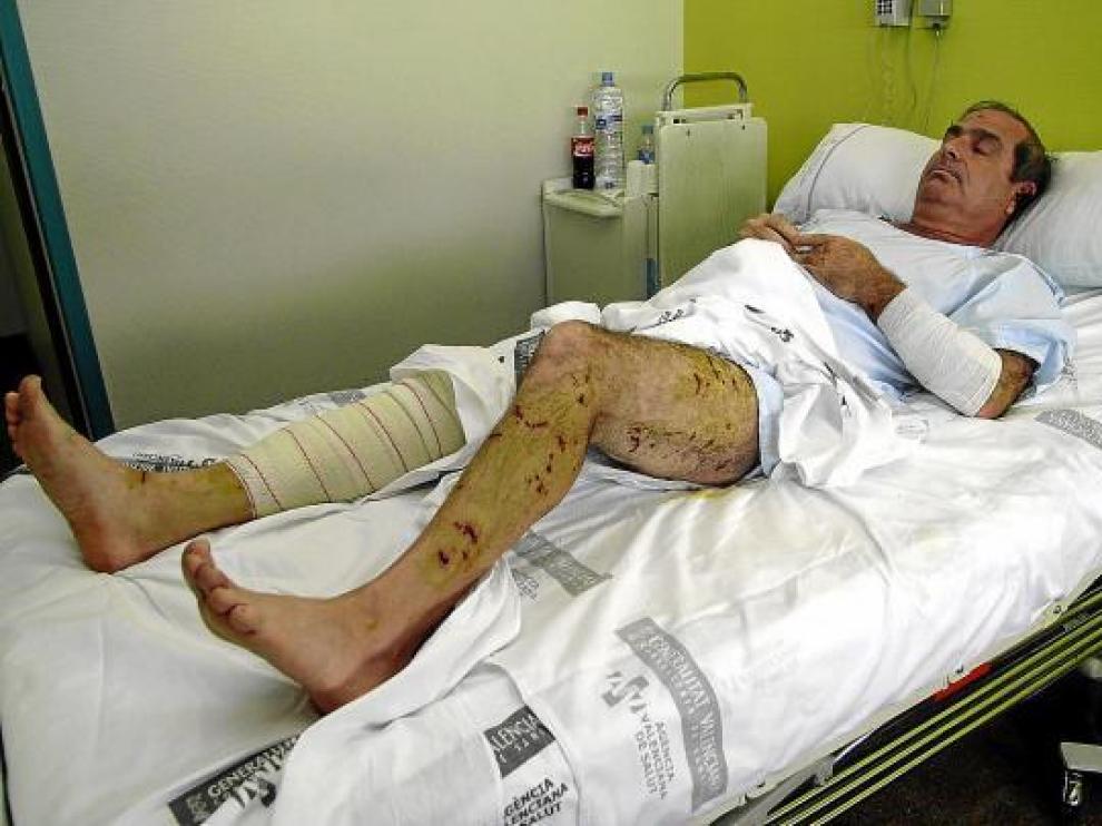Ramón Rubira, con múltiples cicatrices, en su cama del hospital de Villarreal