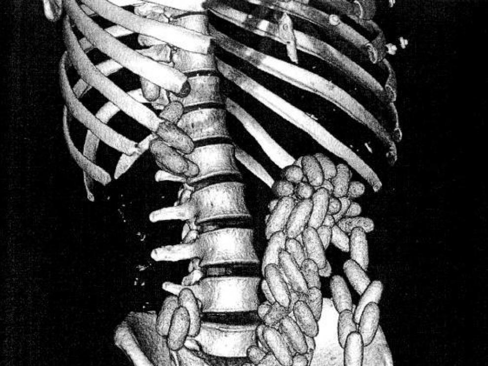 Radiografía de M. E.