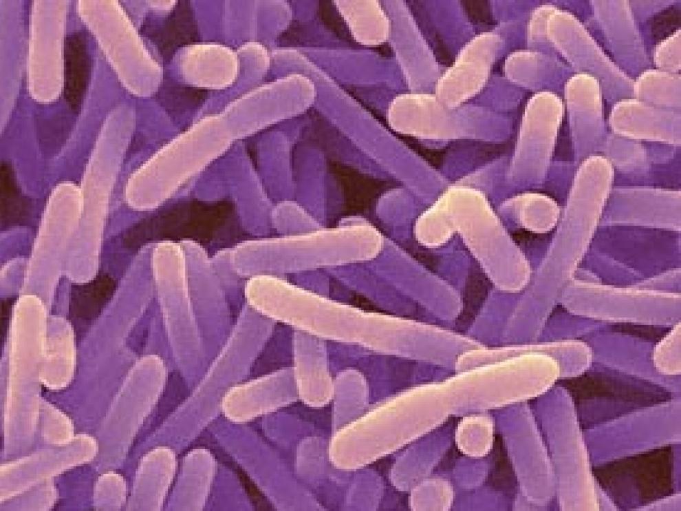 Ejemplo de bifidobacterias; son mayoritarias en los niños y suponen la base de muchos productos probióticos