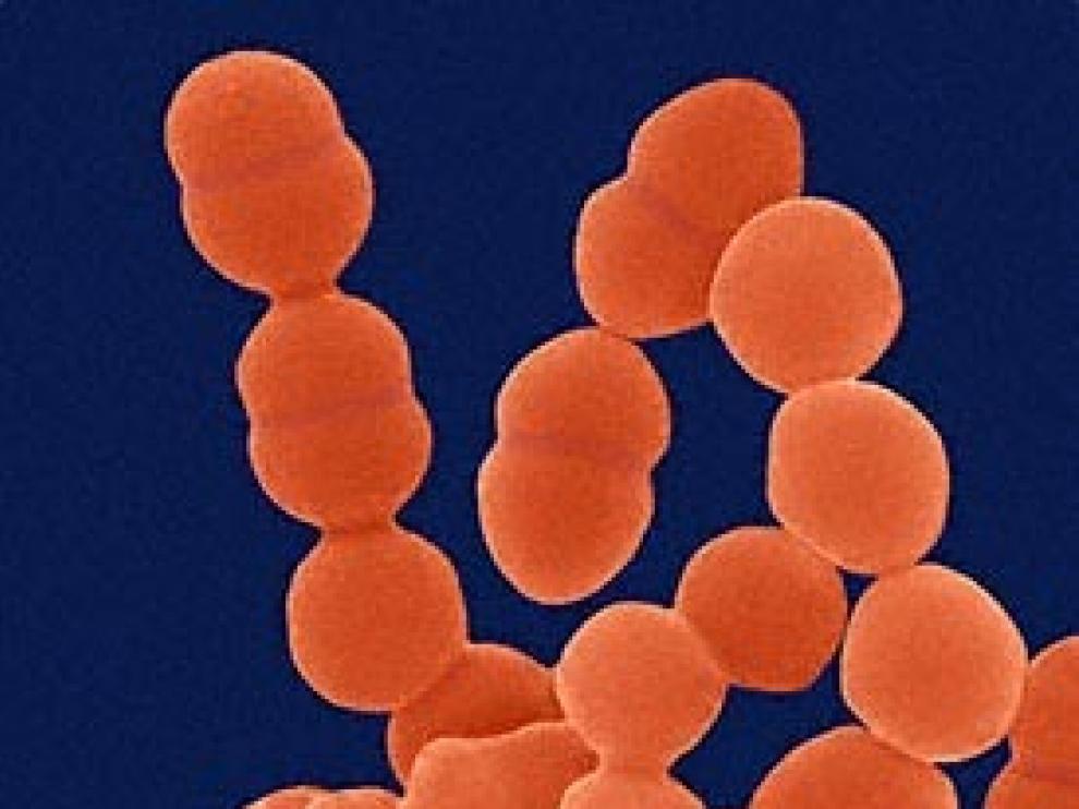 Staphilococcus epidermidis, una bacteria generalmente inofensiva que se encuentra en casi todas las zonas de nuestra piel