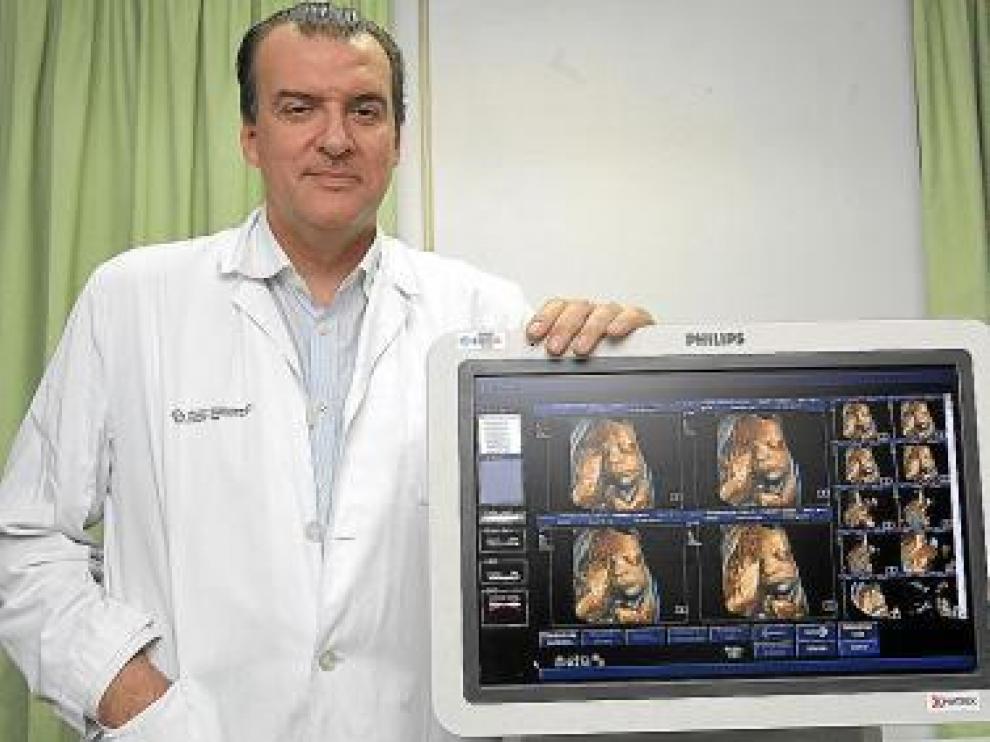 López Ramón y Cajal es experto en esta tecnología.