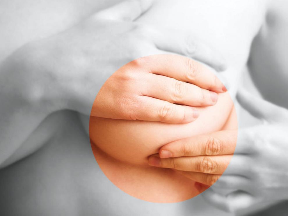 Notar cantos duros en el pecho es uno de los síntomas del cáncer de mama.