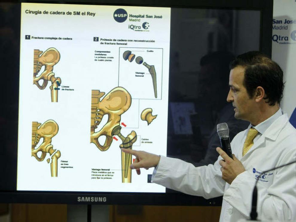 El doctor Villamayor explica los detalles de la operación