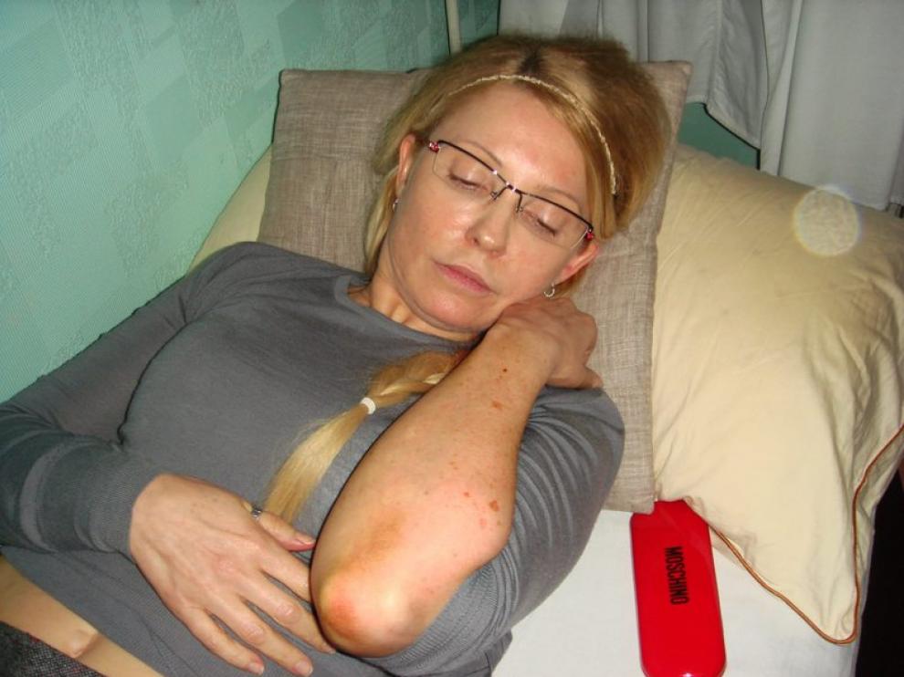 Timoshenko ha accedido a poner fin a su huelga de hambre