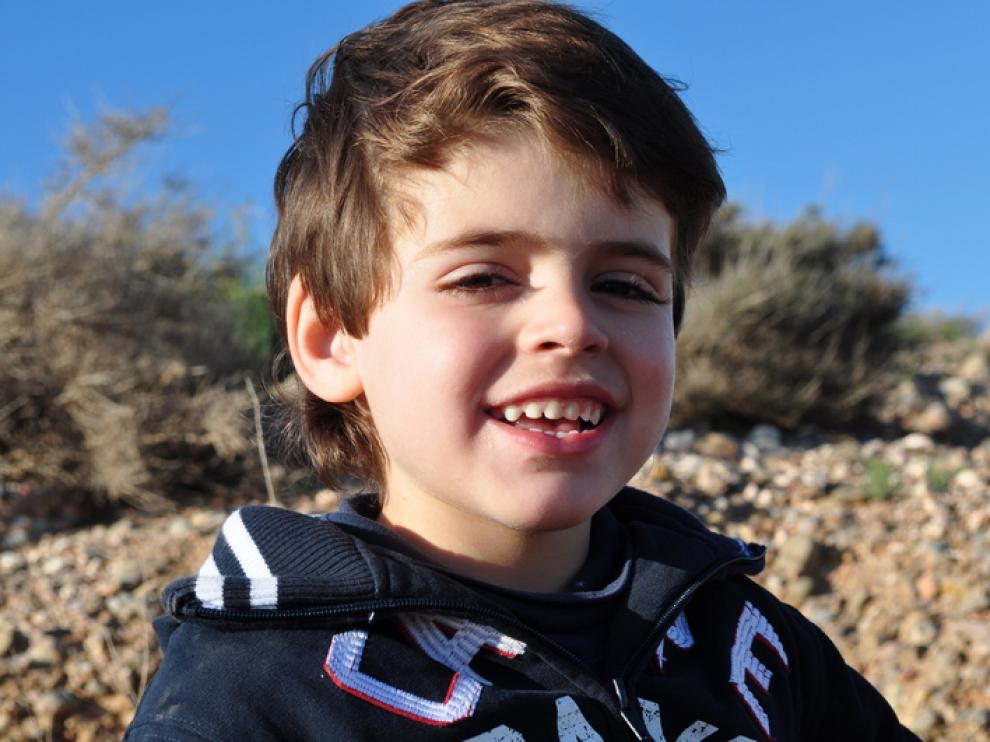 Samuel sufre el raro síndrome de Dravet