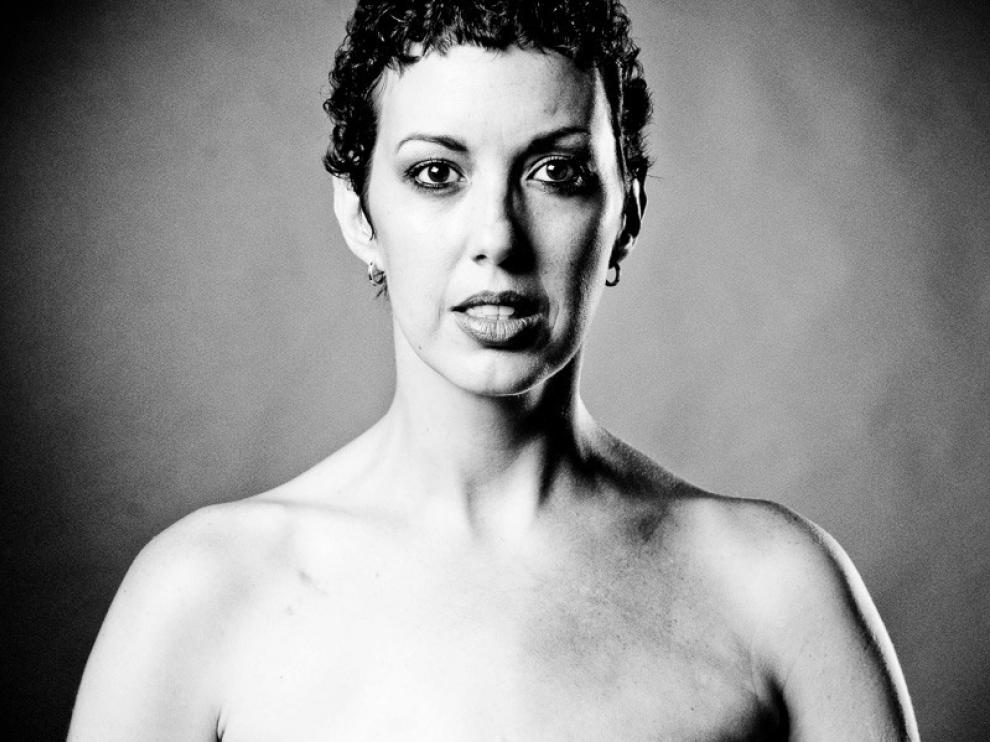 Fotografía de SCAR Project de una mujer sometida a una masectomía, expuesta en Facebook