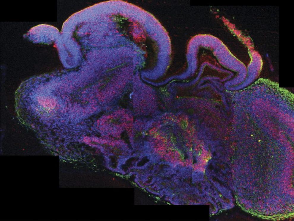Instantánea ampliada que muestra el desarrollo de las diferentes regiones del cerebro