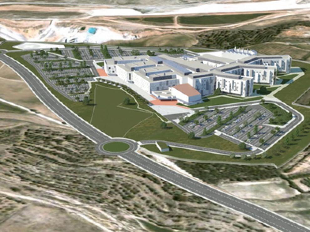 Recreación del proyecto de Hospital en El Planizar