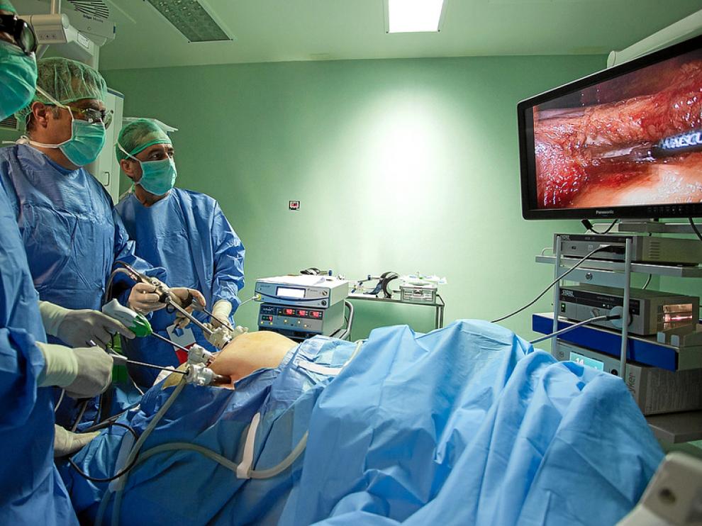 Uno de los instantes de la intervención por laparoscopia con tecnología 3D