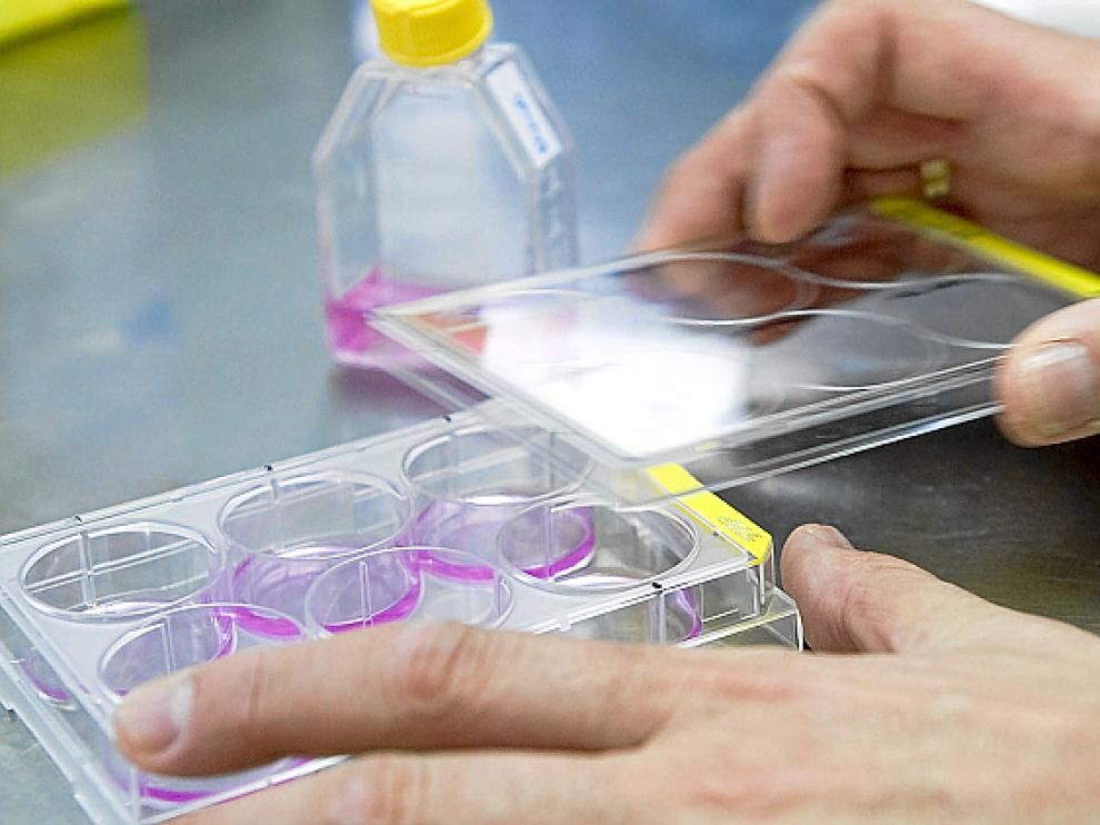 Pruebas de diagnóstico de cáncer, en el laboratorio