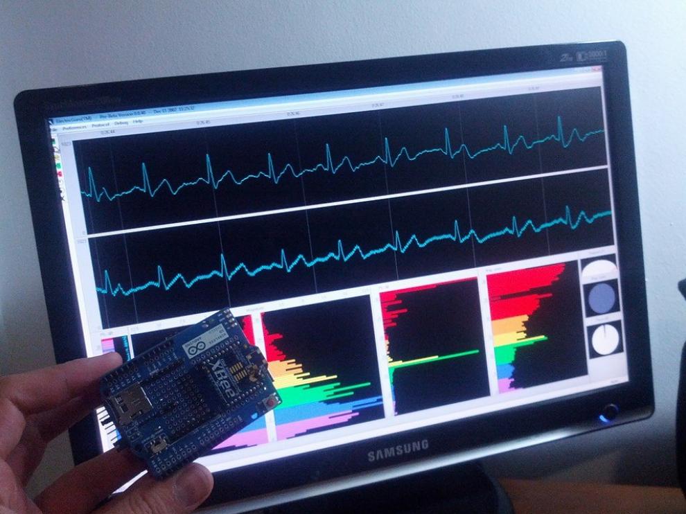 Vital Signs, una tecnología para enfermos cardíacos