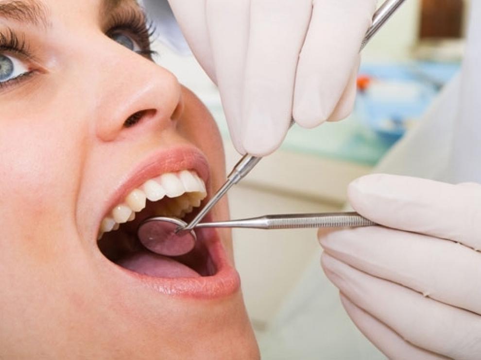 ¿Cada cuánto tiempo es recomendable hacerse una limpieza de boca?