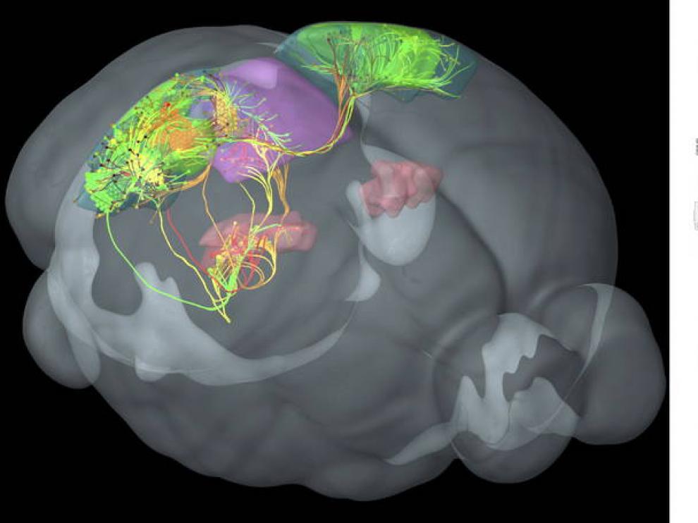 Cerebro humano
