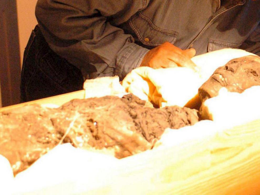 Tutankamon tenía un pie zambo, caderas anchas y dientes de conejo
