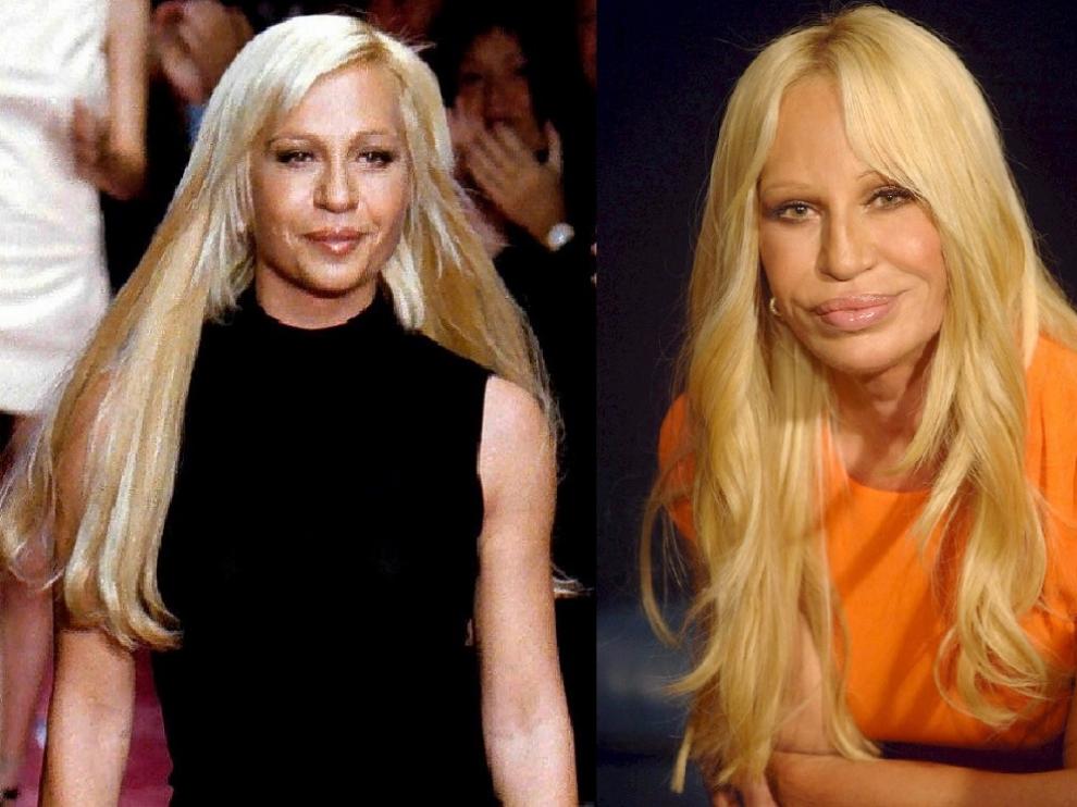 La diseñadora Donatella Versace se ha sometido a numerosas intervenciones