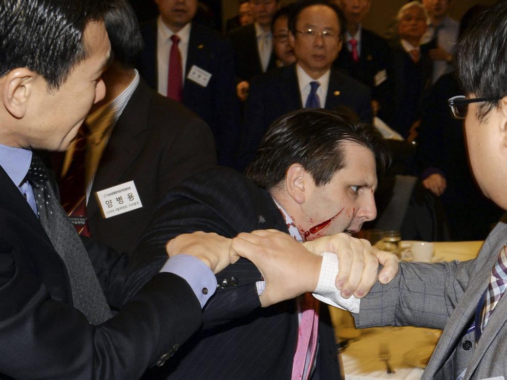 El embajador estadounidense Mark Lippert, tras resultar herido