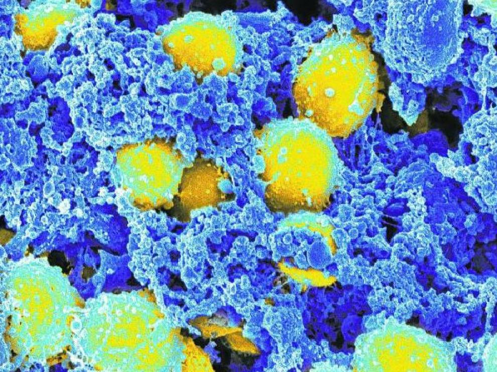 Una forma de la bacteria Staphylococcus aureus (coloreada en amarillo) se muestra resistente a la meticilina.