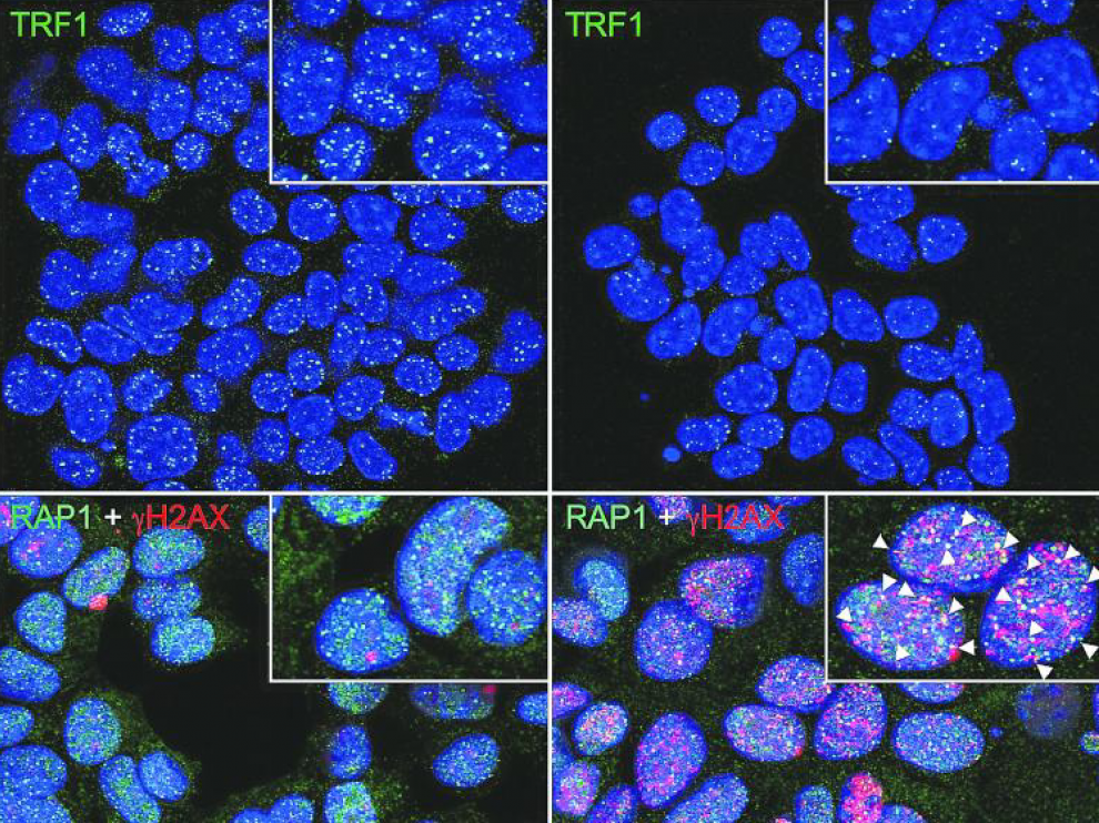 Las células de cáncer de pulmón tratadas con el inhibidor de TRF1 del CNIO muestran menos TRF1 unido a sus telómeros y un mayor daño del ADN telomérico –y, por tanto, una mayor desprotección de los telómeros– que las células cancerosas sin tratar.